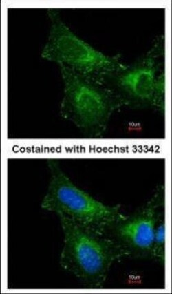 Invitrogen PRDX1 Polyclonal Antibody 100 &mu;L; Unconjugated:Antibodies,