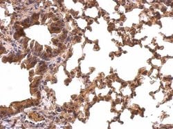 Invitrogen PRDX1 Polyclonal Antibody 100 &mu;L; Unconjugated:Antibodies,