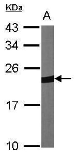 Invitrogen PRDX1 Polyclonal Antibody 100 &mu;L; Unconjugated:Antibodies,