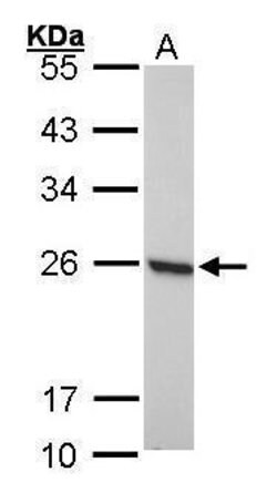 Invitrogen PRDX1 Polyclonal Antibody 100 &mu;L; Unconjugated:Antibodies,