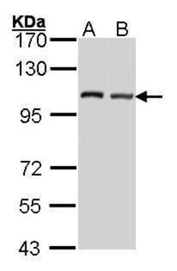 Invitrogen DAP5 Polyclonal Antibody 100 &mu;L | Buy Online | Invitrogen&trade; | Fisher Scientific