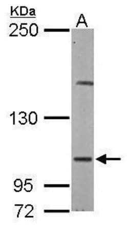 Invitrogen DAP5 Polyclonal Antibody 100 &mu;L | Buy Online | Invitrogen&trade; | Fisher Scientific