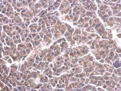 Cytochrome C1 Polyclonal Antibody:Antibodies, Polyclonal