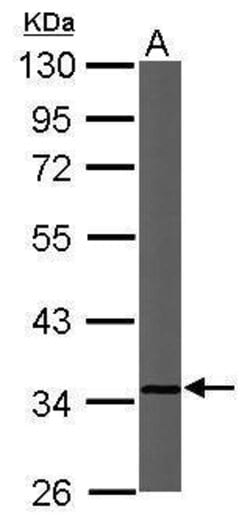 Cytochrome C1 Polyclonal Antibody:Antibodies, Polyclonal