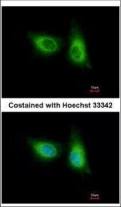 Invitrogen SOS2 Polyclonal Antibody 100 &mu;L | Buy Online | Invitrogen&trade; | Fisher Scientific