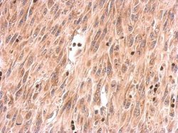 Invitrogen SOS2 Polyclonal Antibody 100 &mu;L; Unconjugated:Antibodies,