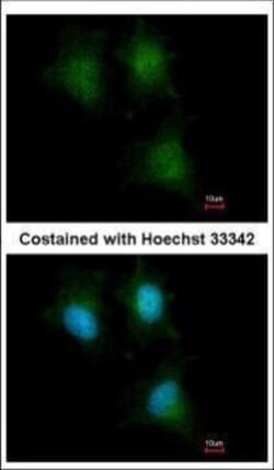 Invitrogen IFITM1 Polyclonal Antibody 100 &mu;L | Buy Online | Invitrogen&trade; | Fisher Scientific