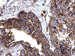 Invitrogen IFITM1 Polyclonal Antibody 100 &mu;L | Buy Online | Invitrogen&trade; | Fisher Scientific