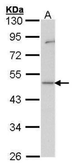 Invitrogen GDI1 Polyclonal Antibody 100 &mu;L; Unconjugated:Antibodies,