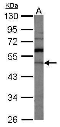Invitrogen GDI1 Polyclonal Antibody 100 &mu;L; Unconjugated:Antibodies,
