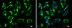 ATP5A1 Polyclonal Antibody:Antibodies, Polyclonal