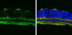 ATP5A1 Polyclonal Antibody:Antibodies, Polyclonal