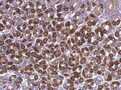ATP5A1 Polyclonal Antibody:Antibodies, Polyclonal