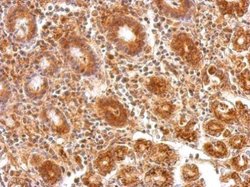 ATP5A1 Polyclonal Antibody:Antibodies, Polyclonal