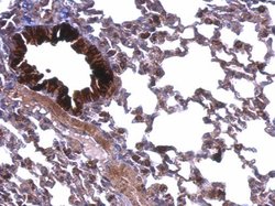 ATP5A1 Polyclonal Antibody:Antibodies, Polyclonal