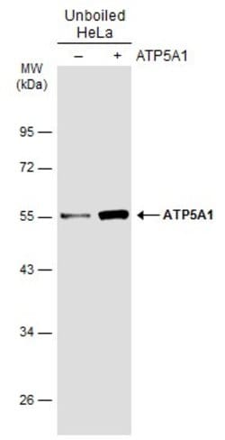 ATP5A1 Polyclonal Antibody:Antibodies, Polyclonal