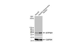 ATP5A1 Polyclonal Antibody:Antibodies, Polyclonal