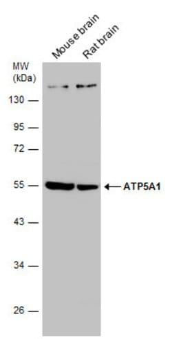 ATP5A1 Polyclonal Antibody:Antibodies, Polyclonal