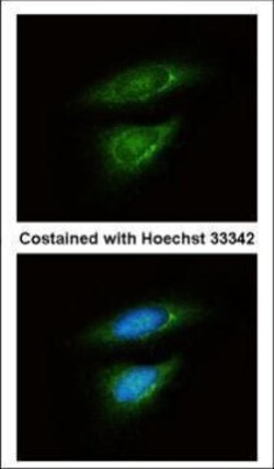 Invitrogen LDHB Polyclonal Antibody 100 &mu;L; Unconjugated:Antibodies,