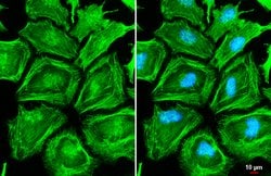 Invitrogen MYH9 Polyclonal Antibody 100 &mu;L; Unconjugated:Antibodies,