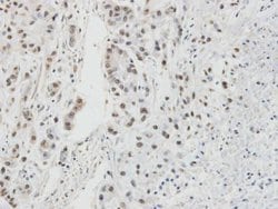 Invitrogen RPA2 Polyclonal Antibody 100 &mu;L; Unconjugated:Antibodies,