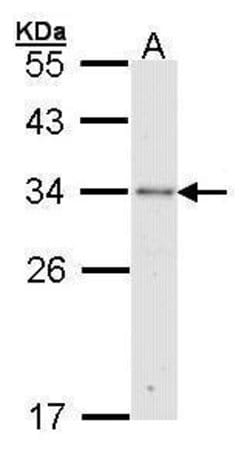 Invitrogen RPA2 Polyclonal Antibody 100 &mu;L; Unconjugated:Antibodies,