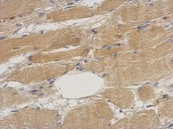 Invitrogen Septin 2 Polyclonal Antibody 100 &mu;L; Unconjugated:Antibodies,