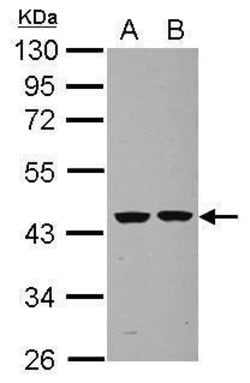 Invitrogen Septin 2 Polyclonal Antibody 100 &mu;L; Unconjugated:Antibodies,