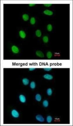 Invitrogen FEN1 Polyclonal Antibody 100 &mu;L; Unconjugated:Anticuerpos
