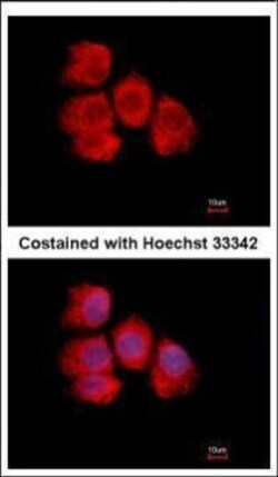 Invitrogen IMPDH2 Polyclonal Antibody 100 &mu;L; Unconjugated:Antibodies,