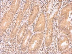Invitrogen IMPDH2 Polyclonal Antibody 100 &mu;L; Unconjugated:Antibodies,