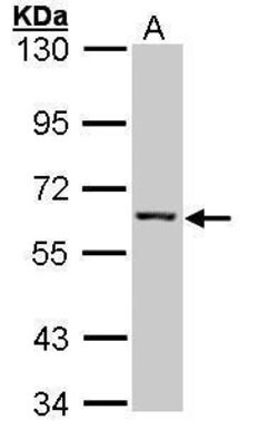 Invitrogen IMPDH2 Polyclonal Antibody 100 &mu;L; Unconjugated:Antibodies,