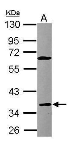Invitrogen CD23 Polyclonal Antibody 100 &mu;L; Unconjugated:Anticuerpos
