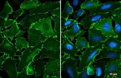 Invitrogen EPB41L3 Polyclonal Antibody 100 &mu;L; Unconjugated:Antibodies,