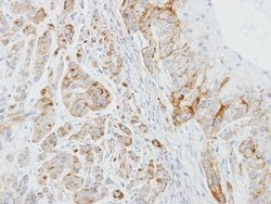 Invitrogen EPB41L3 Polyclonal Antibody 100 &mu;L; Unconjugated:Antibodies,