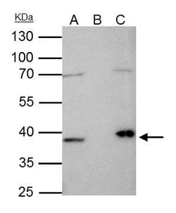 Invitrogen Fibrillarin Polyclonal Antibody 100 &mu;L; Unconjugated:Antibodies,