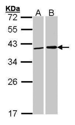 Invitrogen Fibrillarin Polyclonal Antibody 100 &mu;L; Unconjugated:Antibodies,