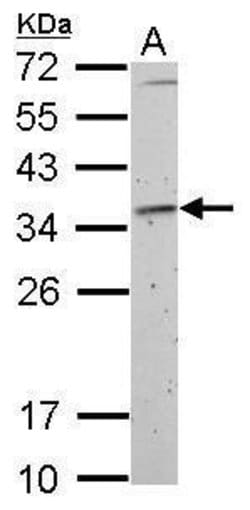 Invitrogen Fibrillarin Polyclonal Antibody 100 &mu;L; Unconjugated:Antibodies,