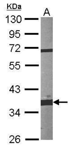 Invitrogen Fibrillarin Polyclonal Antibody 100 &mu;L; Unconjugated:Antibodies,