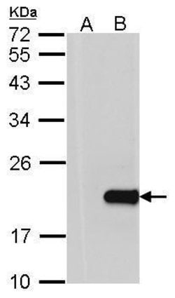 Invitrogen HPCAL1 Polyclonal Antibody 100 &mu;L; Unconjugated:Antibodies,