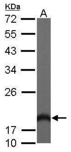 Invitrogen HPCAL1 Polyclonal Antibody 100 &mu;L; Unconjugated:Antibodies,