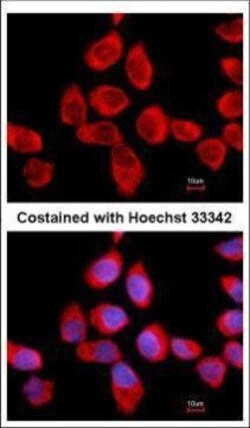 Invitrogen RPLP2 Polyclonal Antibody 100 &mu;L; Unconjugated:Antibodies,