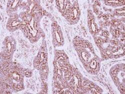 Invitrogen NDUFS5 Polyclonal Antibody 100 &mu;L | Buy Online | Invitrogen&trade; | Fisher Scientific