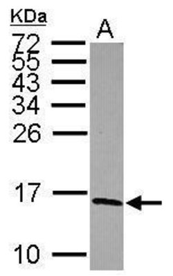 Invitrogen NDUFS5 Polyclonal Antibody 100 &mu;L | Buy Online | Invitrogen&trade; | Fisher Scientific