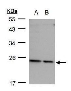 Invitrogen RPL17 Polyclonal Antibody 100 &mu;L; Unconjugated:Antibodies,