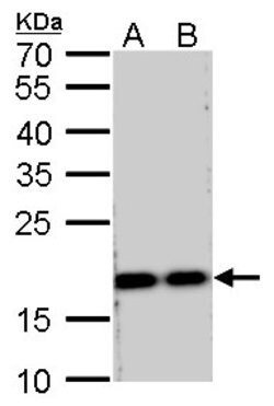 Invitrogen RPS15 Polyclonal Antibody 100 &mu;L; Unconjugated:Antibodies,