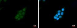 Invitrogen SNRPD2 Polyclonal Antibody 100 μL; Unconjugated:Antibodies,