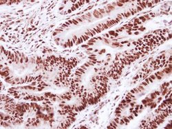 Invitrogen SNRPD2 Polyclonal Antibody 100 μL; Unconjugated:Antibodies,