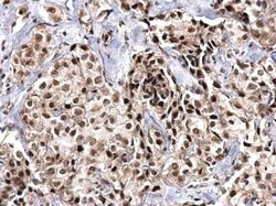 Invitrogen SNRPD2 Polyclonal Antibody 100 μL; Unconjugated:Antibodies,