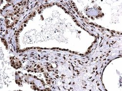 Invitrogen SNRPD2 Polyclonal Antibody 100 μL; Unconjugated:Antibodies,
